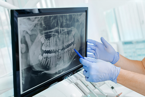 Dentist gesturing to computer screen showing x rays of teeth